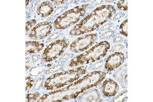 Immunohistochemistry of paraffin-embedded mouse kidney using Alkaline Phosphatase (Alkaline Phosphatase (ALPL)) Rabbit pAb (ABIN6133557, ABIN6136824, ABIN6136825 and ABIN6216013) at dilution of 1:200 (40x lens). (ALPL 抗体  (AA 150-250))