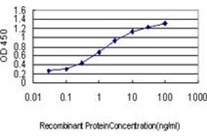 Detection limit for recombinant GST tagged BTBD9 is approximately 0. (BTBD9 抗体  (AA 2-70))