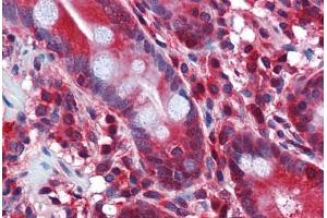 anti-Stress-Induced-phosphoprotein 1 (STIP1) (AA 445-544) antibody