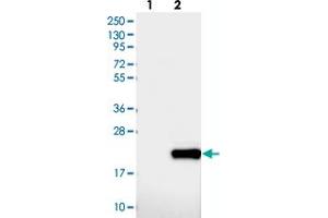Western blot analysis of Lane 1: Negative control (vector only transfected HEK293T lysate), Lane 2: Over-expression Lysate (Co-expressed with a C-terminal myc-DDK tag (~3. (DNAJC24 抗体)