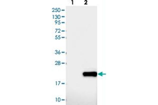 DNAJC24 抗体