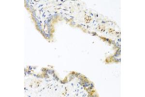 Immunohistochemistry of paraffin-embedded mouse lung using RETN antibody (ABIN5974977) at dilution of 1/100 (40x lens). (Resistin 抗体)