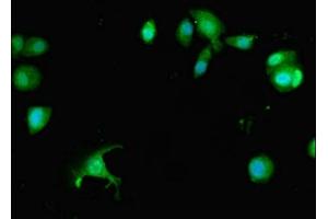 Immunofluorescent analysis of MCF-7 cells using ABIN7163177 at dilution of 1:100 and Alexa Fluor 488-congugated AffiniPure Goat Anti-Rabbit IgG(H+L) (PREX1 抗体  (AA 1-44))