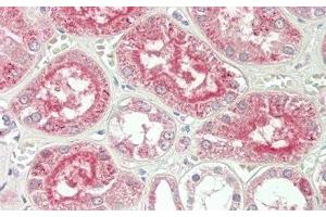 Detection of ALT in Human Kidney Tissue using Polyclonal Antibody to Alanine Aminotransferase (ALT) (ALT 抗体  (AA 147-263))