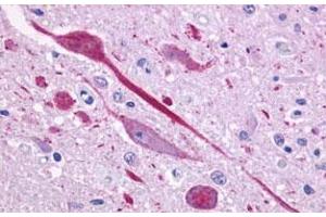 Immunohistochemical (Formalin/PFA-fixed paraffin-embedded sections) staining in human brain, neurons and glia with P2RY14 polyclonal antibody . (P2RY14 抗体  (C-Term))
