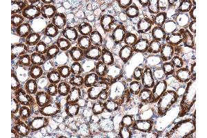 IHC-P Image ILK antibody [N1C1] detects ILK protein at cytoplasm in mouse kidney by immunohistochemical analysis. (ILK 抗体)