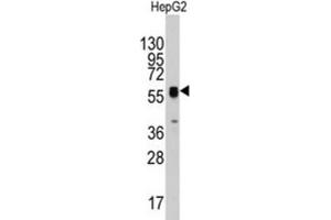Western Blotting (WB) image for anti-Thymidine Phosphorylase (TYMP) antibody (ABIN3003120)