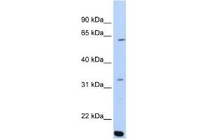 ARID5A antibody used at 0. (ARID5A 抗体  (C-Term))