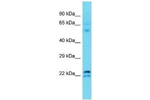 Host: Rabbit Target Name: TMEM182 Sample Type: Fetal Liver lysates Antibody Dilution: 1. (TMEM182 抗体  (N-Term))