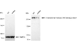 Western blotting analysis using Chromodomain helicase DNA binding protein 4 antibody (ABIN7800918). (Recombinant Chromodomain Helicase DNA Binding 4 抗体)
