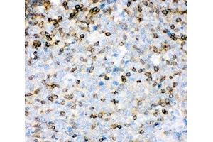 IHC-P: IL16 antibody testing of human tonsil tissue (IL16 抗体  (AA 1212-1332))