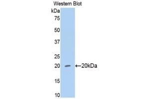WB of Protein Standard: different control antibodies against Highly purified E. (MMP13 CLIA Kit)