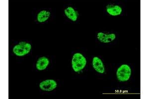 Immunofluorescence of monoclonal antibody to HES2 on HeLa cell. (HES2 抗体  (AA 41-114))