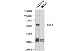 Western blot analysis of extracts of various cell lines, using MICB antibody (ABIN6133301, ABIN6143831, ABIN6143832 and ABIN6225101) at 1:1000 dilution. (MICB 抗体  (AA 23-108))