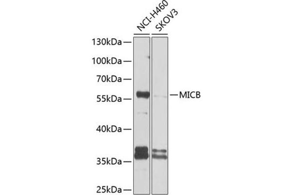 MICB 抗体  (AA 23-108)