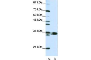 Western Blotting (WB) image for anti-Heterogeneous Nuclear Ribonucleoprotein A1 (HNRNPA1) antibody (ABIN2462116) (HNRNPA1 抗体)