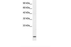 Image no. 2 for anti-Homeobox A1 (HOXA1) (C-Term) antibody (ABIN202024) (HOXA1 抗体  (C-Term))
