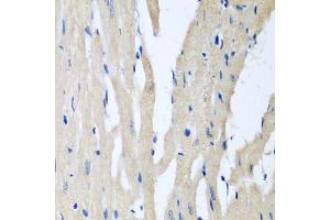 Immunohistochemistry of paraffin-embedded rat heart using PITRM1 antibody. (PITRM1 抗体  (AA 758-1037))