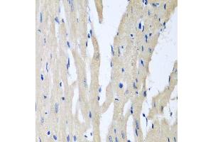 Immunohistochemistry of paraffin-embedded rat heart using PITRM1 antibody. (PITRM1 抗体  (AA 758-1037))