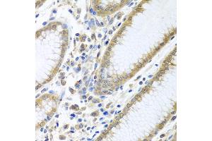 Immunohistochemistry of paraffin-embedded human stomach using EIF4E antibody (ABIN5971189) at dilution of 1/100 (40x lens). (EIF4E 抗体)