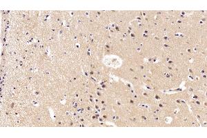 Detection of BDNF in Porcine Cerebrum Tissue using Polyclonal Antibody to Brain Derived Neurotrophic Factor (BDNF) (BDNF 抗体  (AA 20-252))