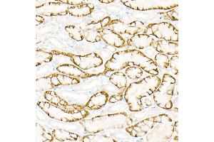 Immunohistochemistry (IHC) image for anti-Aquaporin 4 (AQP4) (AA 244-323) antibody (ABIN3016921)