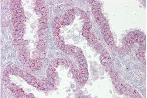 Immunohistochemistry with Uterus tissue at an antibody concentration of 5µg/ml using anti-CDK9 antibody (AVARP03004_P050) (CDK9 抗体  (N-Term))