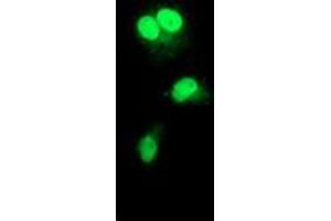 Anti-RAD51L1 mouse monoclonal antibody (ABIN2455028) immunofluorescent staining of COS7 cells transiently transfected by pCMV6-ENTRY RAD51L1 (RC206457). (RAD51 Homolog B 抗体  (AA 119-346))