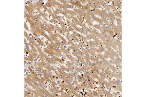 Immunohistochemical staining of human liver with AGT polyclonal antibody  shows moderate cytoplasmic positivity in hepatocytes. (AGT 抗体)