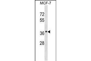 Western blot analysis in MCF-7 cell line lysates (35ug/lane). (MRPL2 抗体  (C-Term))