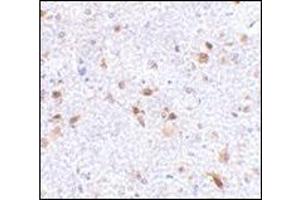 Immunohistochemistry of PDL-2 in mouse brain tissue with this product at 2. (PDCD1LG2 抗体  (Center))