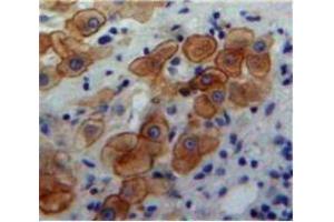 IHC-P analysis of Liver tissue, with DAB staining. (BMP5 抗体  (AA 317-454))