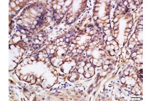 Formalin-fixed and paraffin embedded mouse colon labeled with Rabbit Anti-Glutamine synthetase Polyclonal Antibody, Unconjugated (ABIN754468) at 1:200 followed by conjugation to the secondary antibody and DAB staining (GLN1 抗体  (AA 285-373))