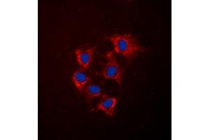 Immunofluorescence (IF) image for anti-Collagen, Type IV, alpha 5 (COL4A5) (N-Term) antibody (ABIN7299170)