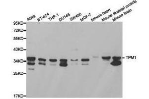 Western Blotting (WB) image for anti-Tropomyosin 1 (Alpha) (TPM1) antibody (ABIN1875180) (Tropomyosin 抗体)