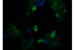 Image no. 3 for anti-TAP Binding Protein-Like (TAPBPL) antibody (ABIN1501299)