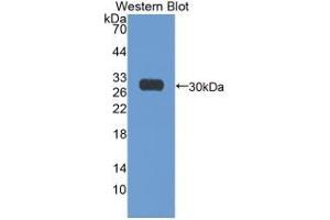 WB of Protein Standard: different control antibodies against Highly purified E.