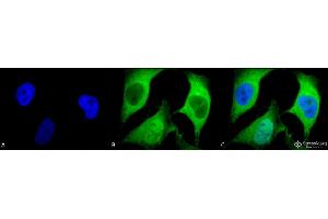 Immunocytochemistry/Immunofluorescence analysis using Mouse Anti-Ubiquitin Monoclonal Antibody, Clone 5B9-B3 . (Ubiquitin 抗体  (FITC))