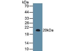 Detection of Recombinant RARS, Human using Monoclonal Antibody to Arginyl tRNA Synthetase (RARS) (RARS 抗体  (AA 1-146))