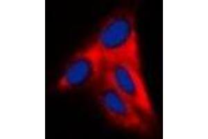 Immunofluorescent analysis of Alpha-tubulin staining in Hela cells.