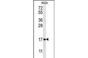 TBCA Antibody (N-term) (ABIN656928 and ABIN2846121) western blot analysis in WiDr cell line lysates (35 μg/lane). (TBCA 抗体  (N-Term))