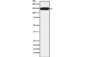 Western blot analysis of Pumilio 1 expression in HeLa cell lysate.