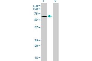 Western Blot analysis of PCK1 expression in transfected 293T cell line by PCK1 monoclonal antibody (M01), clone 3E4. (PCK1 抗体  (AA 1-622))