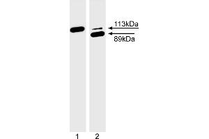 Western Blotting (WB) image for anti-Poly (ADP-Ribose) Polymerase 1 (PARP1) (full length) antibody (ABIN967515) (PARP1 抗体  (full length))