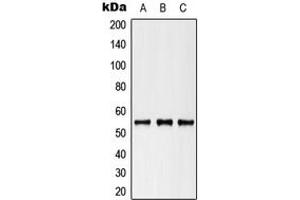 Western blot analysis of Cytokeratin 8 (pS73) expression in HeLa (A), NIH3T3 (B), H9C2 (C) whole cell lysates. (KRT8 抗体  (pSer73))