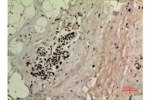 Immunohistochemistry (IHC) image for anti-Tumor Protein P53 (TP53) (acLys370) antibody (ABIN3181892)