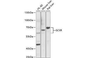 Western blot analysis of extracts of various cell lines, using GCKR Antibody (ABIN6131695, ABIN6141014, ABIN6141015 and ABIN6221331) at 1:1000 dilution. (GCKR 抗体  (AA 1-300))