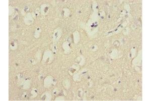 Immunohistochemistry of paraffin-embedded human brain tissue using ABIN7153074 at dilution of 1:100 (FOXN2 抗体  (AA 172-431))