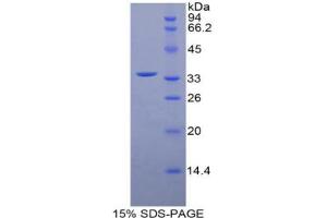 SDS-PAGE analysis of Mouse MYLK4 Protein. (MYLK4 蛋白)