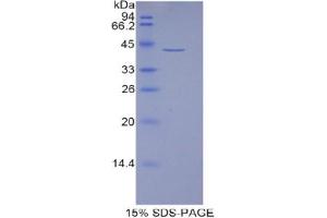 SDS-PAGE analysis of Human HIST1H2AJ Protein. (HIST1H2AJ 蛋白)